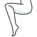 combplasztika